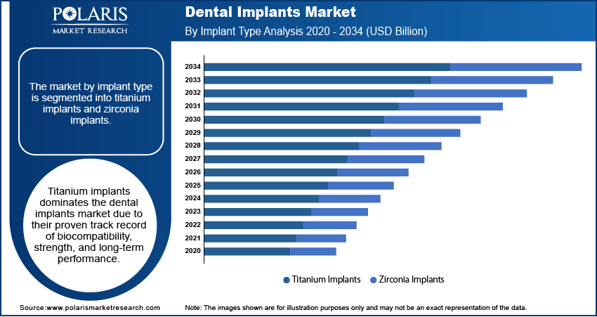 Dental Implants Market Size